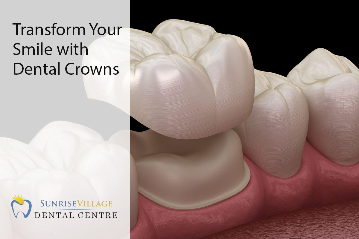 dental crowns