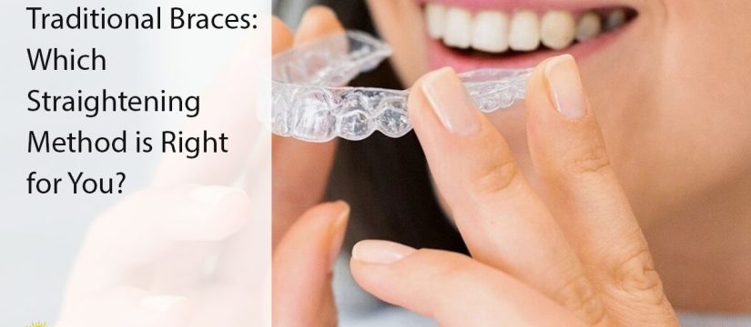 Invisalign