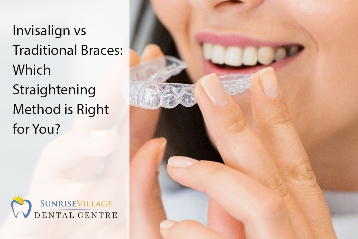 Invisalign vs Traditional Braces