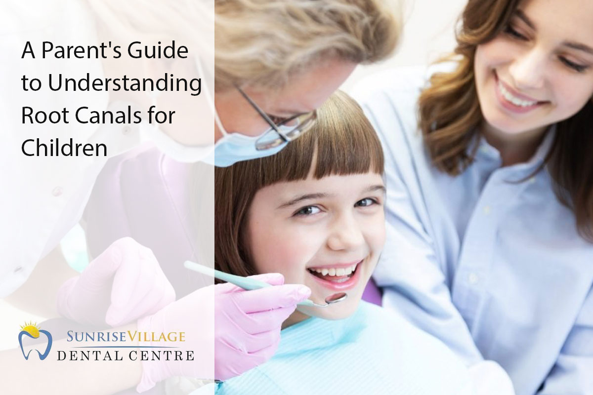 A Parent's Guide to Understanding Root Canals for Children - Sunrise ...