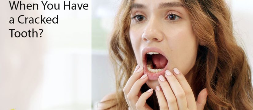 cracked tooth