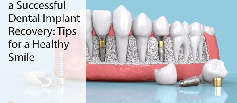 dental implant