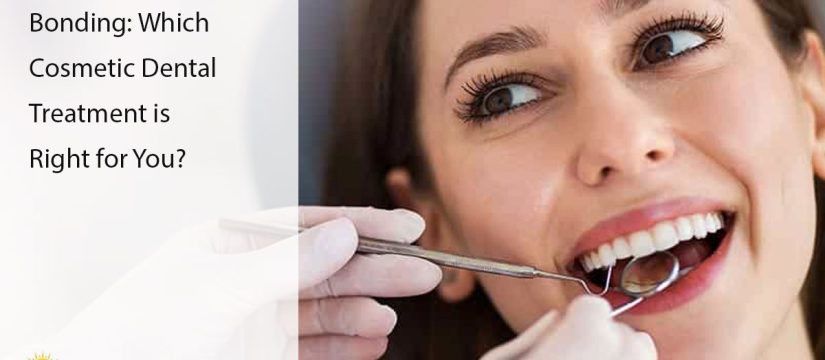 veneer or bonding