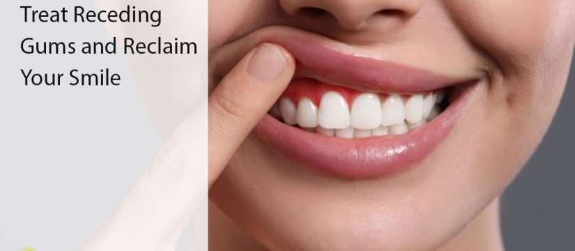 receding gums