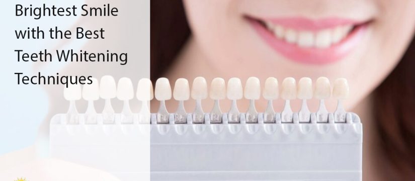 teeth whitening