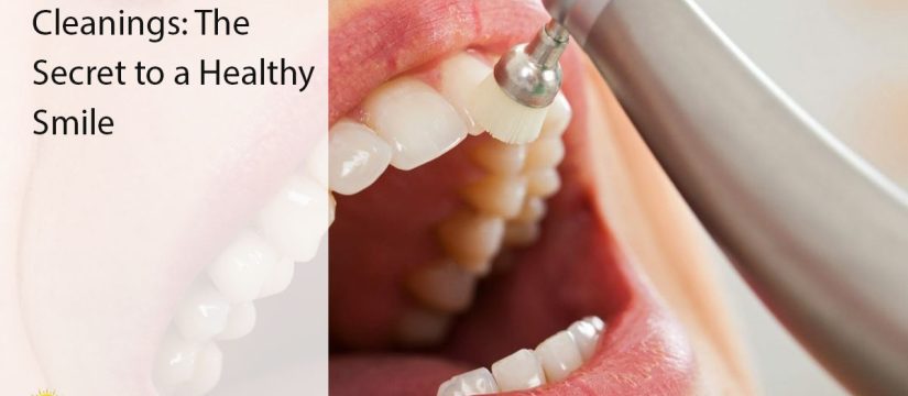 dental cleaning