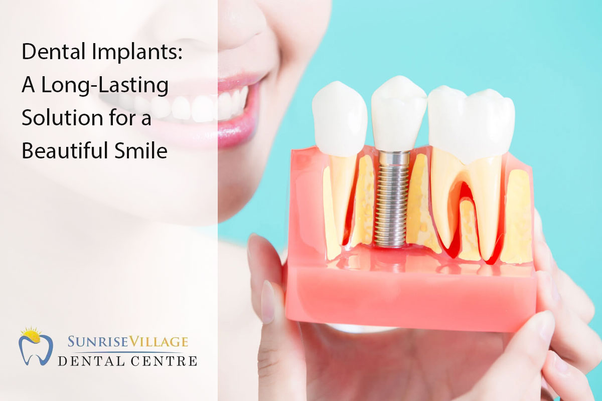dental implants