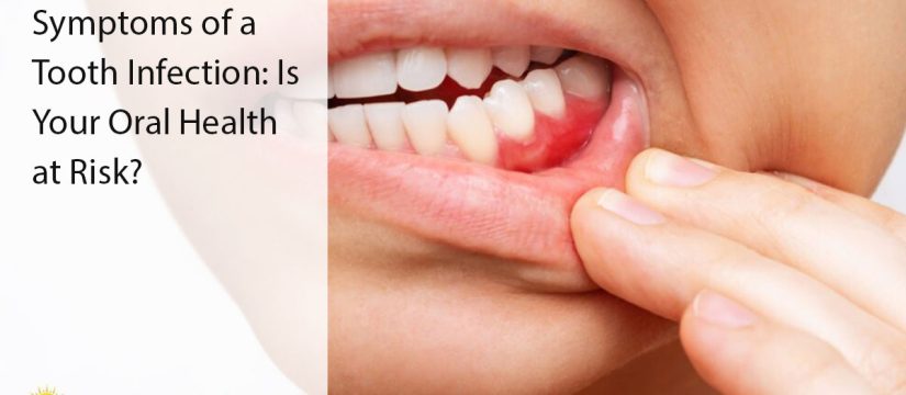 tooth infection
