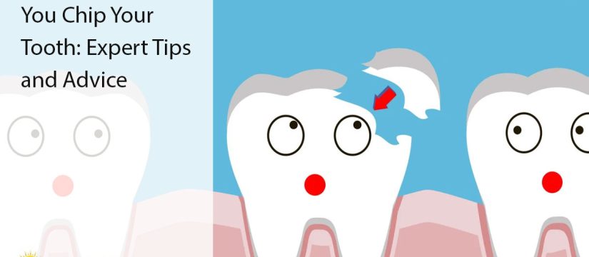 chipped tooth