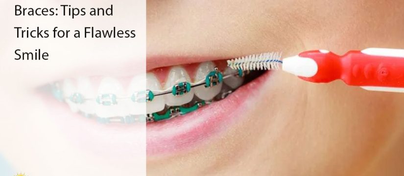 caring for braces